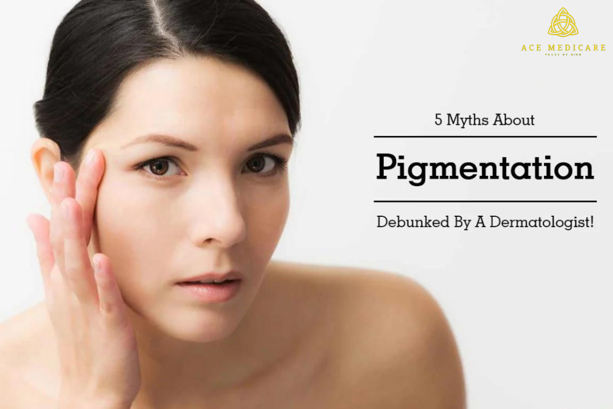 5 Common Myths About Skin Pigmentation Debunked
